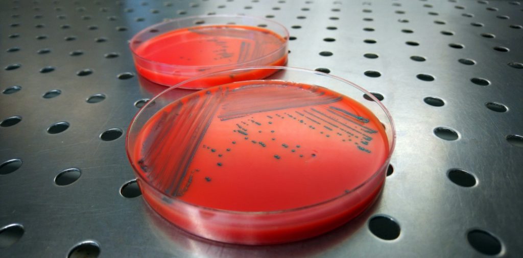 De nouvelles normes européennes dans la lutte contre Listeria monocytogenes : un renforcement indispensable de la sécurité alimentaire